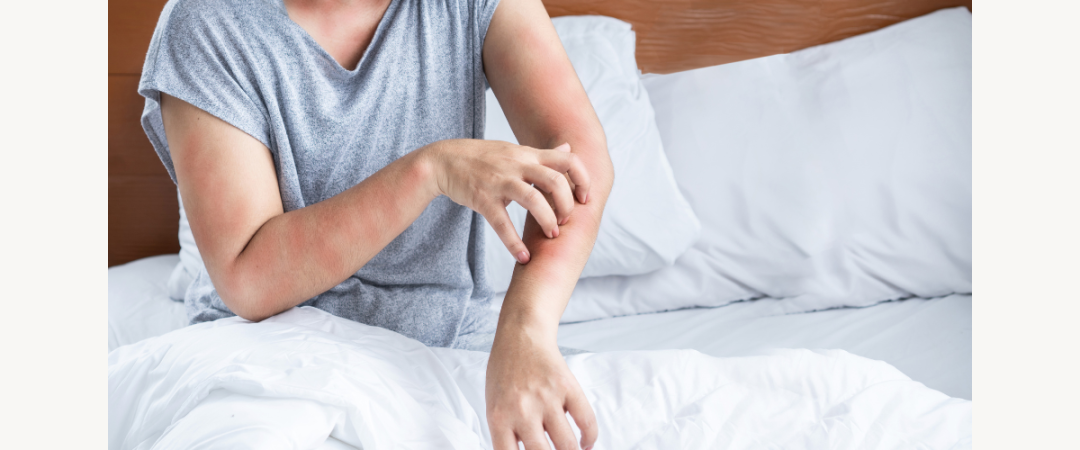 #méthode anti punaise de lit #désinfection naturelle punaise de lit  #désinfecteur de punaise de lit #désinfection anti punaise Aix Les Bains